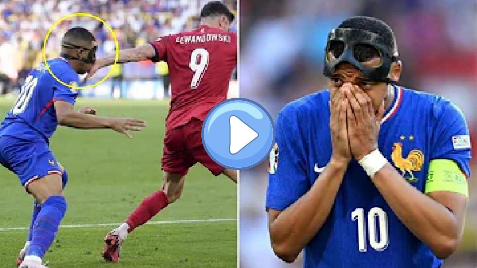 Video thumb: Mbappe upset after Lewandowski hit his broken nose