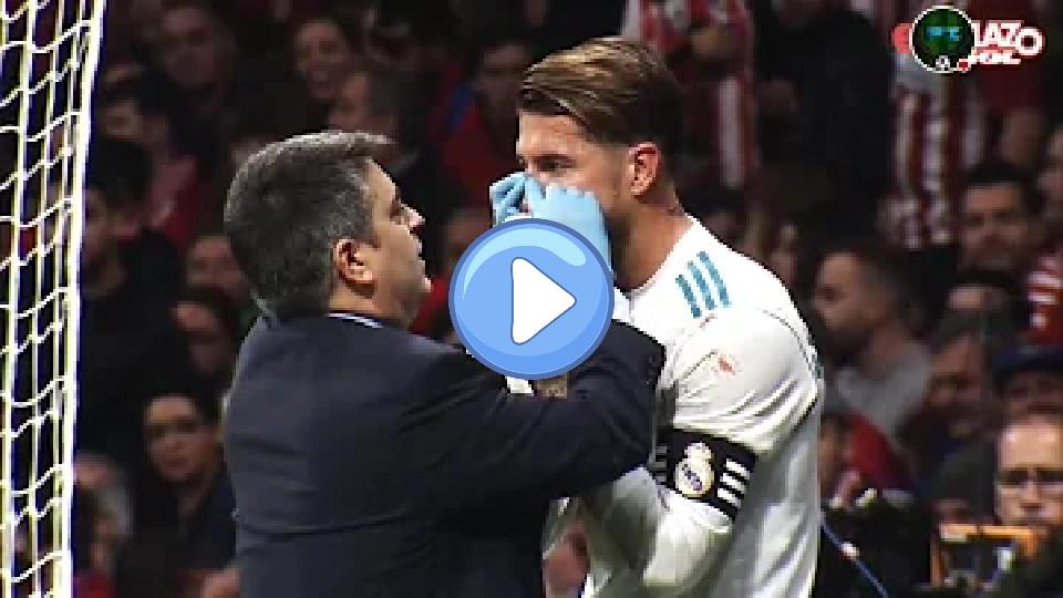 Video thumb: The details of Sergio Ramos' injury