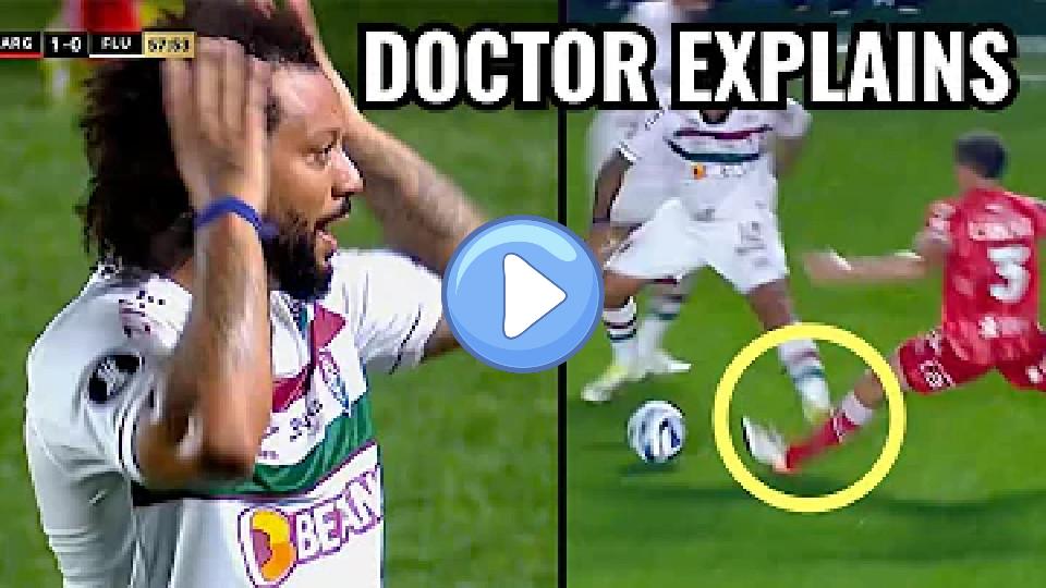 Video thumb: Horrible Leg Injury: Marcelo Steps on Luciano Sanchez, Doctor Explains