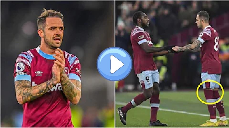 Video thumb: Danny Ings' knee injury vs. Everton.