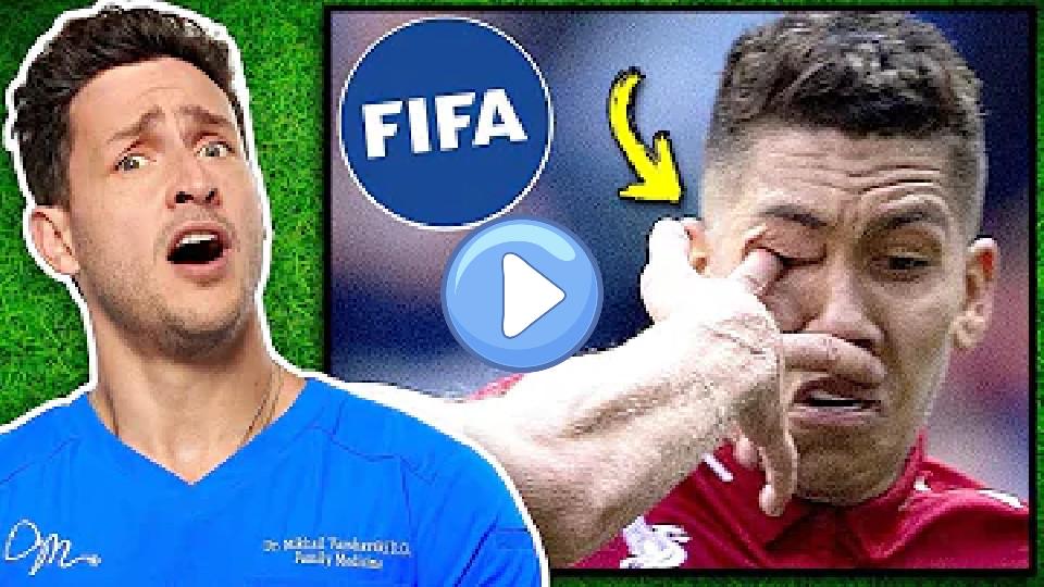 Video thumb: Doctor Reacts to Intense Soccer Injuries