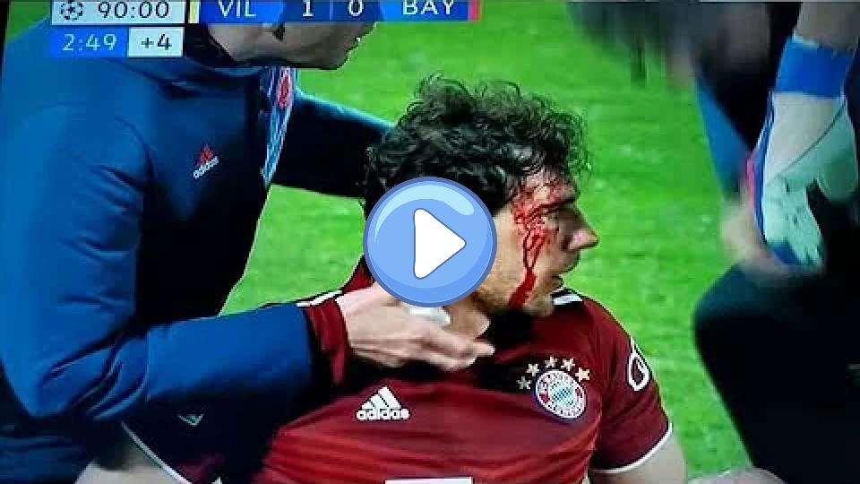 Video thumb: Goretzka elbowed by Pau Torres vs Villarreal