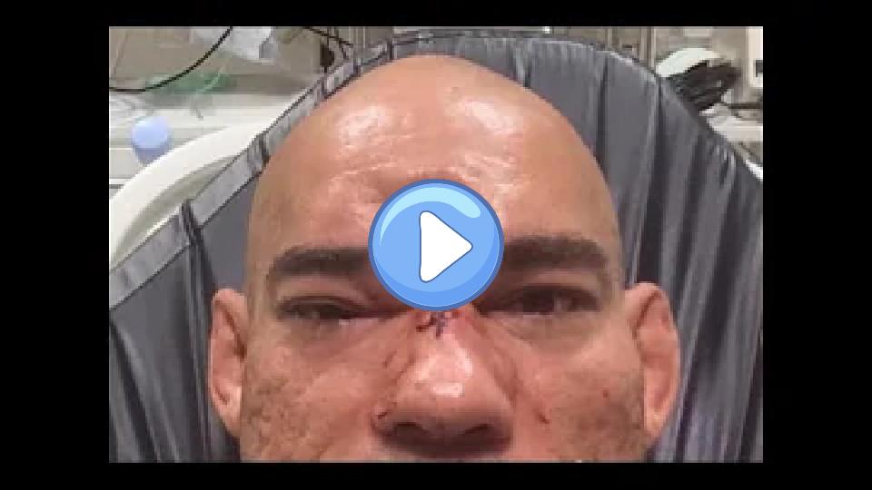 Video thumb: Cyborg's skull fractured by MVP (Worst MMA injury Joe Rogan has ever seen)