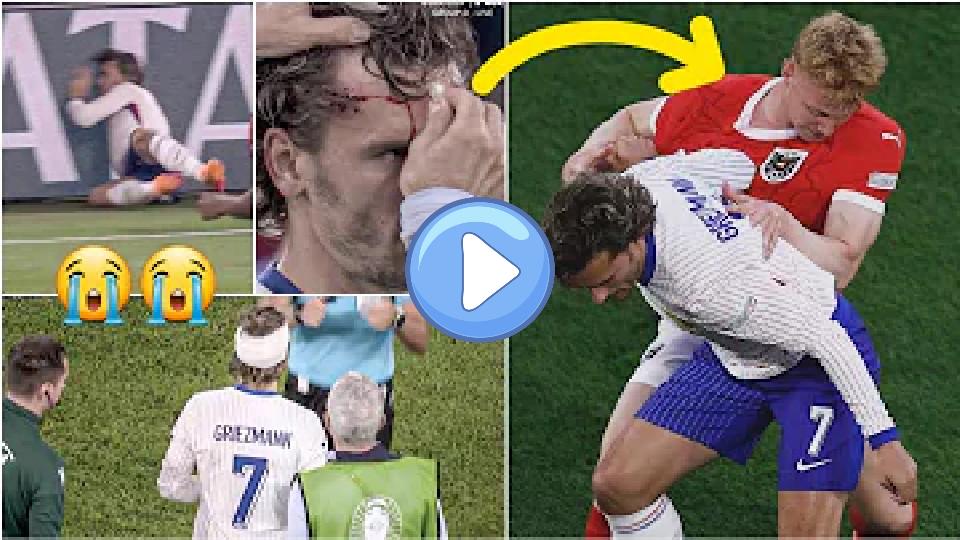 Video thumb: 🇫🇷 France's Antoine Griezmann bleeding after painfully colliding with advertising board vs Austria