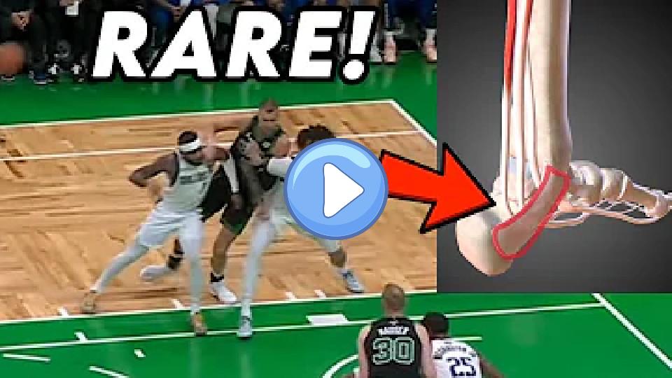 Video thumb: Porzingis Has an Injury Nobody’s Heard of and Luka Doncic Needs Pain Shots - Doctor Explains