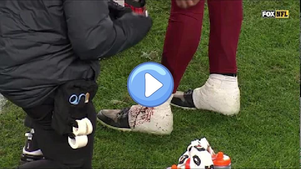 Play video: Alex Smith Injury vs Steelers | NFL Week 13 Video thumb: Alex Smith Injury vs Steelers | NFL Week 13