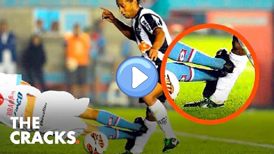 Video thumb: The time Ronaldinho's leg was nearly broken