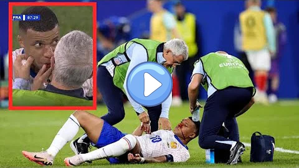 Video thumb: Kylian Mbappe's nose injury vs. Austria