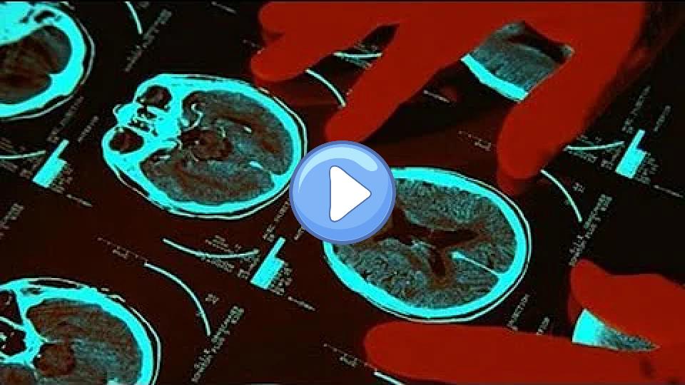 Play video: Surgeon: 'Impossible' to Predict Schumacher's Outcome Video thumb: Surgeon: 'Impossible' to Predict Schumacher's Outcome