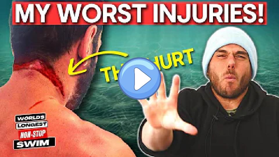Video thumb: The 5 Worst Injuries in Long-Distance Swimming