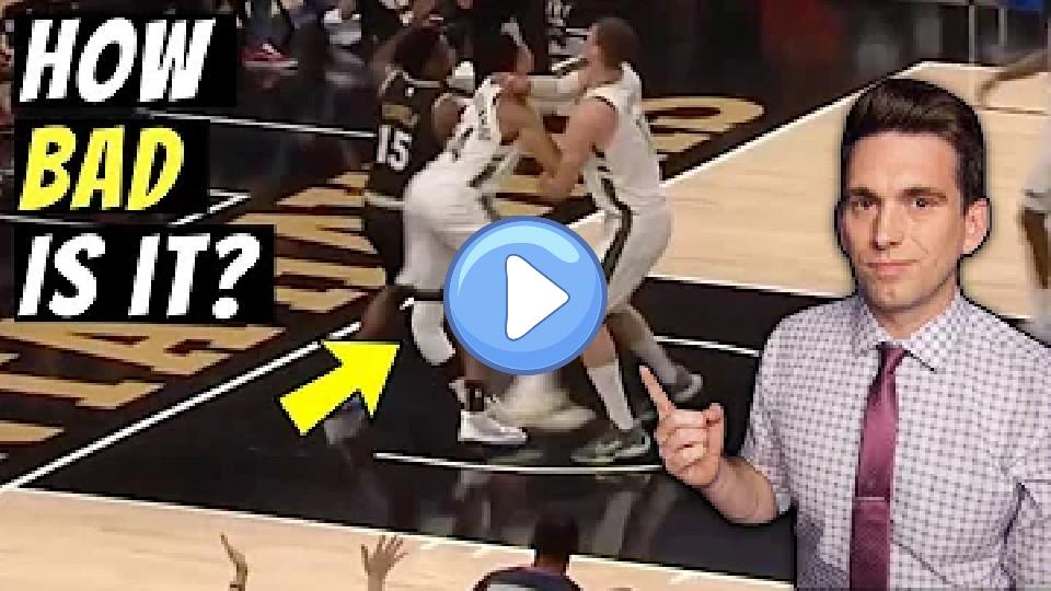 Video thumb: Doctor Reacts to Giannis Antetokounmpo's Severe Knee Injury & Explains What Happened