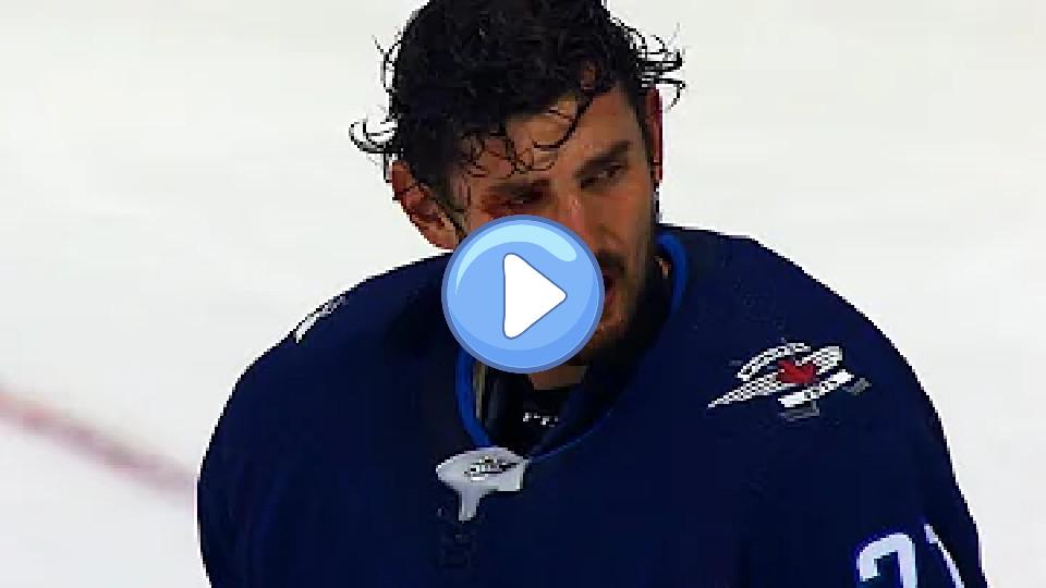 Video thumb: Jets' Hellebuyck cut open after Morrissey's stick accidentally clips him.