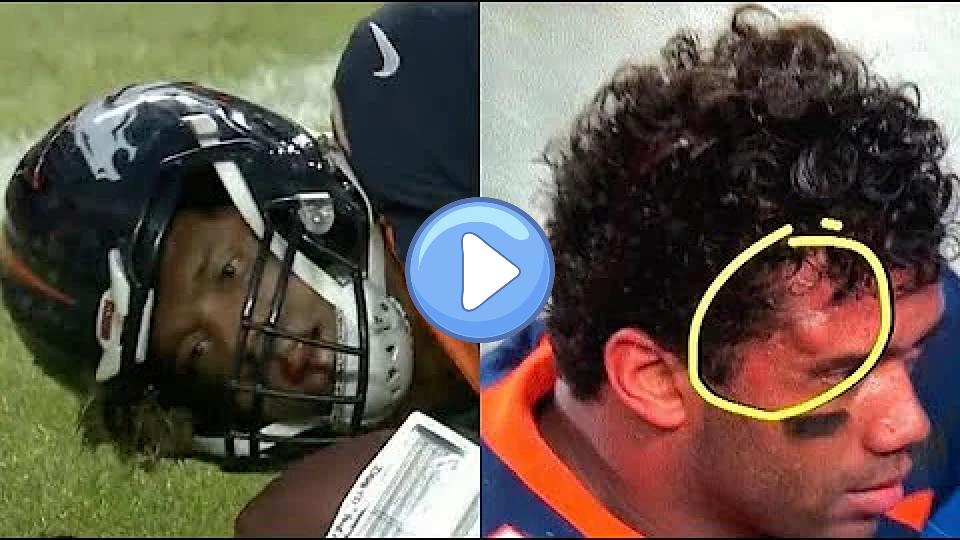 Video thumb: Russell Wilson Suffers Scary Injury, Sustains Concussion 🚑