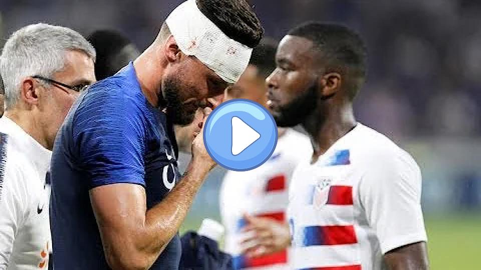 Video thumb: Olivier Giroud Sustains Severe Head Injury against USA during International Friendly