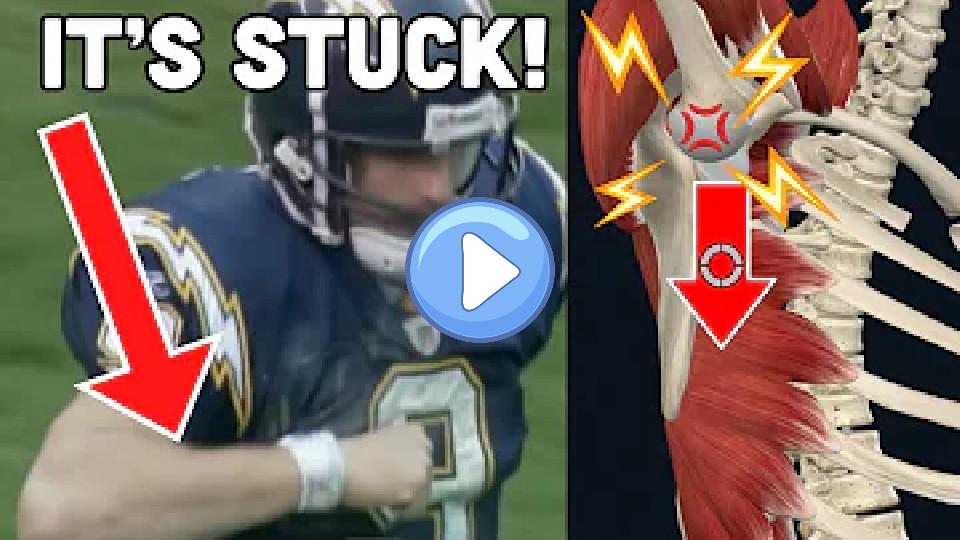 Video thumb: Worst NFL Shoulder Injury? Doctor Explains Why Drew Brees Can't Throw