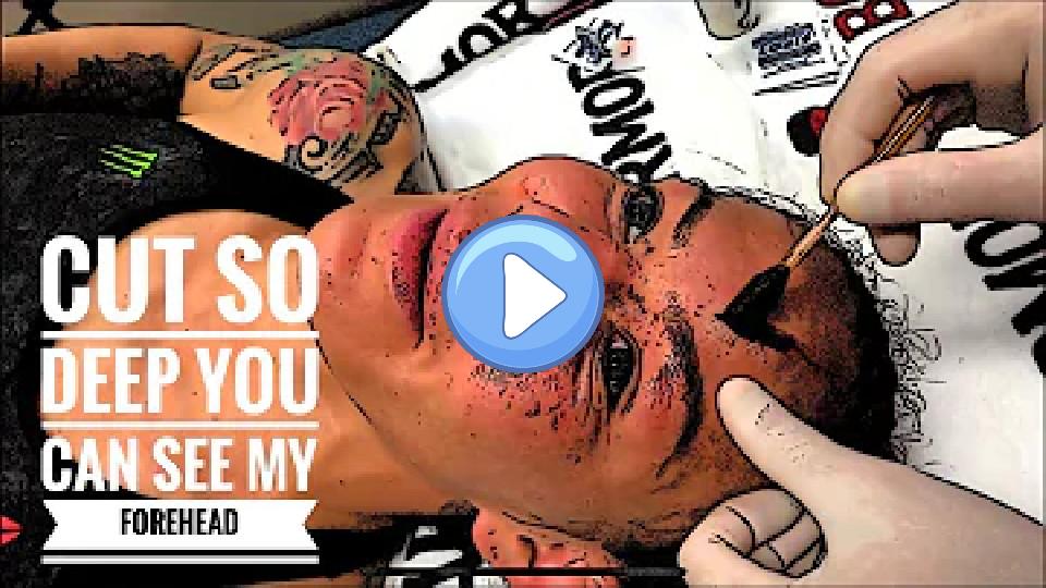 Video thumb: Cris Cyborg UFC 240 MMA cut so deep you can see her skull.