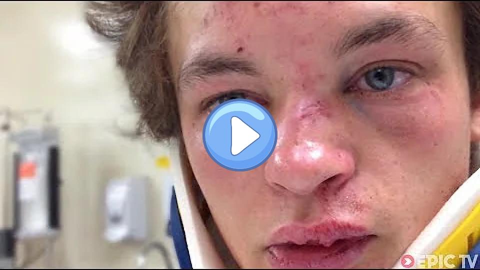 Video thumb: MTB Head Injury at Red Bull Joyride, Recovery | Brayden Barrett-Hay: Regaining Psyche, Ep. 1