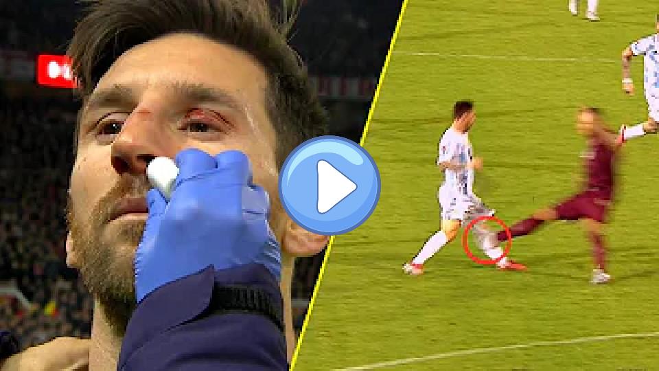 Video thumb: Horror Tackles on Lionel Messi