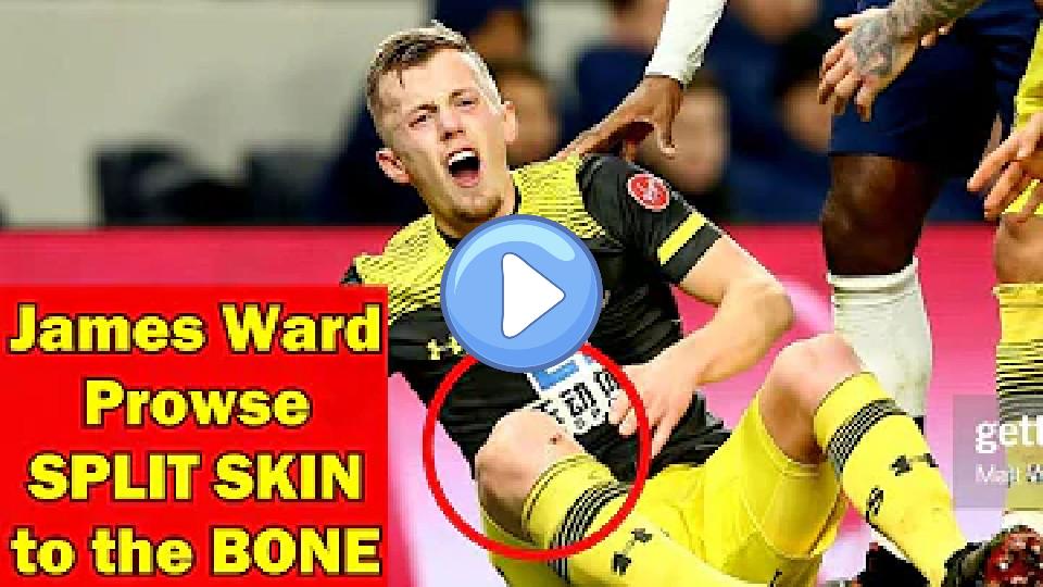 Video thumb: James Ward-Prowse suffers bone injury in Tottenham vs Southampton match.