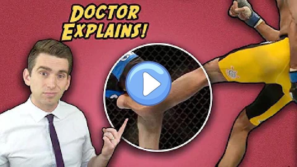 Video thumb: The Untold Side of the Most Famous Injury in UFC History - Anderson Silva's Broken Leg