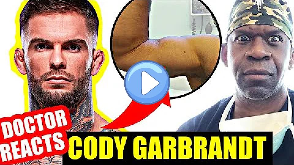 Video thumb: Doctor Reacts to UFC Injuries: Cody Garbrandt's Bicep Injury - Dr. Chris Raynor