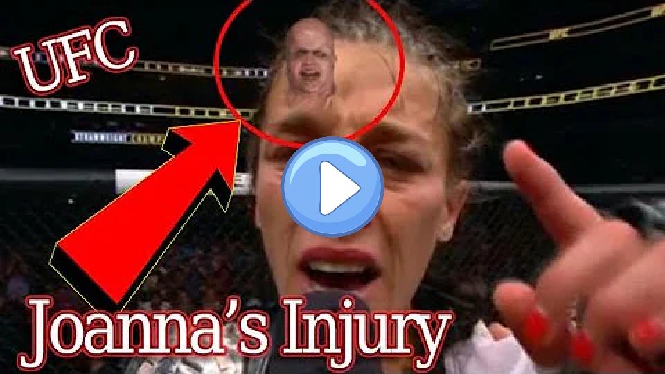 Play video: Joanna Jędrzejczyk UFC 211 Massive Head Injury Post-Victory Speech Video thumb: Joanna Jędrzejczyk UFC 211 Massive Head Injury Post-Victory Speech