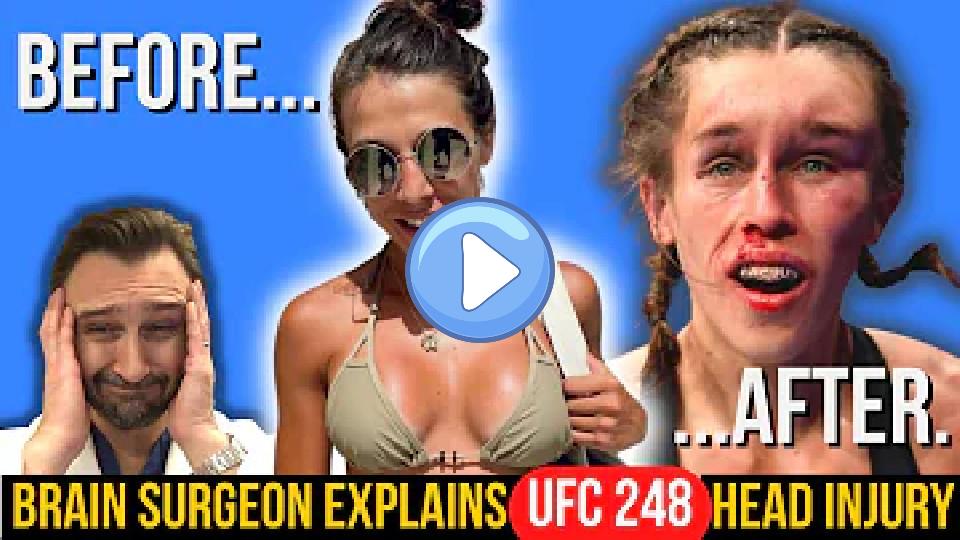Play video: Brain Surgeon Explains Shocking UFC 248 Head Injury | Joanna Jedrzejczyk vs. Zhang Weili Video thumb: Brain Surgeon Explains Shocking UFC 248 Head Injury | Joanna Jedrzejczyk vs. Zhang Weili