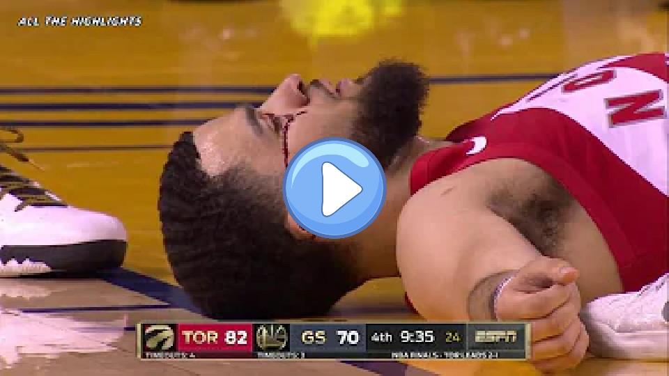 Video thumb: Fred VanVleet Injury Moments | NBA Finals Game 4 | 2019 Playoffs