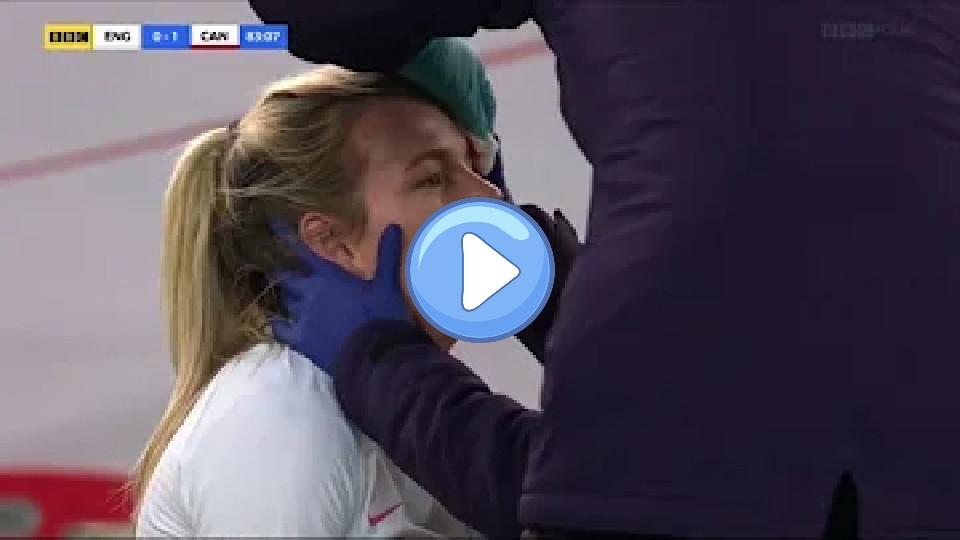 Play video: Lauren Hemp suffers a head injury with the Lionesses. Video thumb: Lauren Hemp suffers a head injury with the Lionesses.