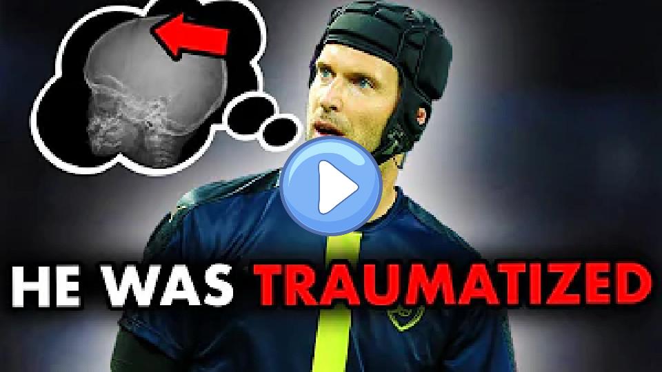 Video thumb: Goalkeeper Who Survived the Worst Injury in Football