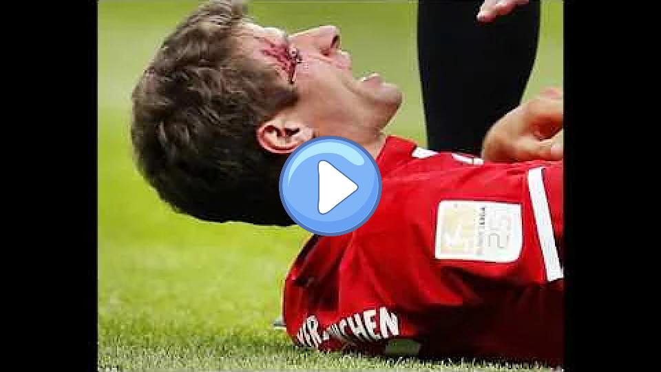 Video thumb: Thomas Müller battles through a nasty gash to his right eye.