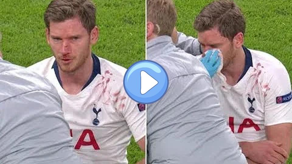 Play video: Soccer needs to improve its concussion protocol. Video thumb: Soccer needs to improve its concussion protocol.