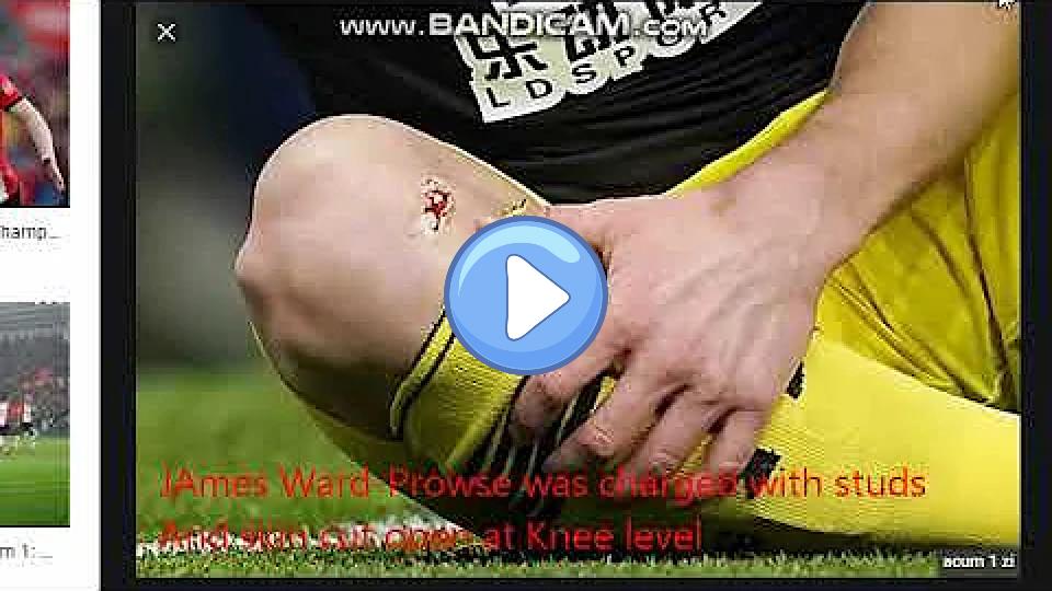 Video thumb: James Ward-Prowse shocking injury: Skin cut open in Tottenham-Southampton FA Cup.