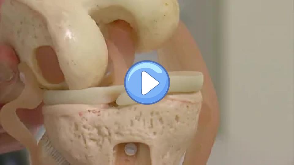 Play video: Surgeon: Bridgewater’s Injury ‘Unusual’ Video thumb: Surgeon: Bridgewater’s Injury ‘Unusual’