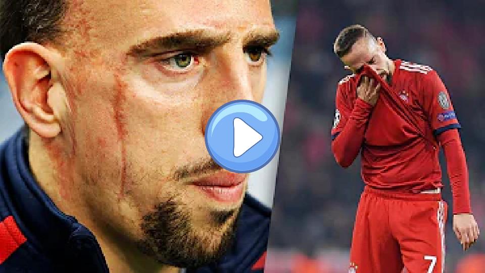 Video thumb: What's the story behind Franck Ribery's scars?