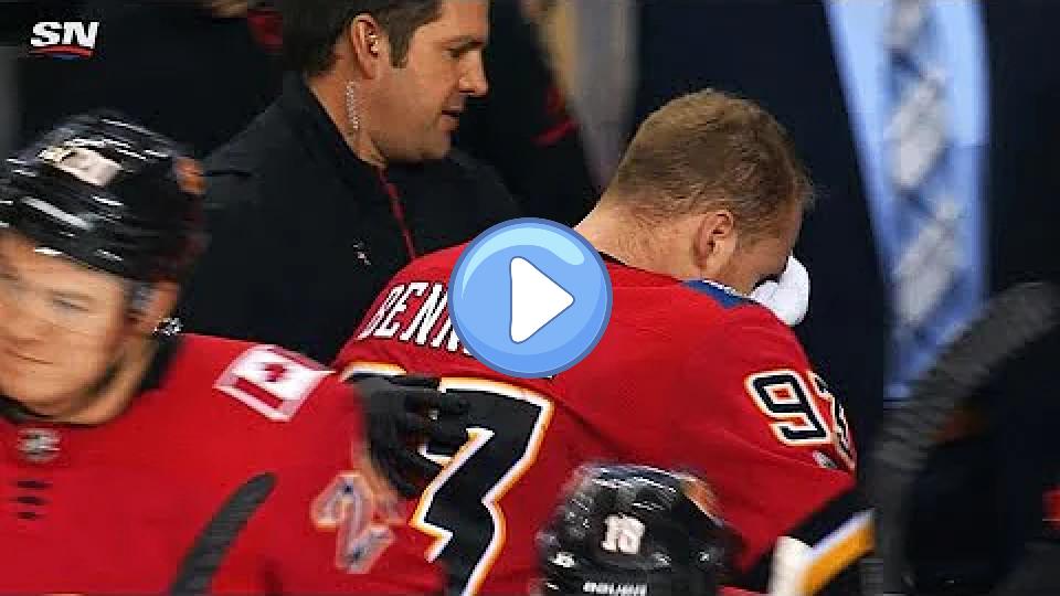 Play video: Sam Bennett takes a shot from Frederik Andersen to the face and leaves bleeding. Video thumb: Sam Bennett takes a shot from Frederik Andersen to the face and leaves bleeding.