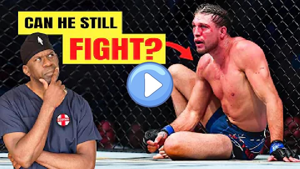 Video thumb: Why Brian Ortega's Shoulder Injury is Very Bad | Doctor Reacts to Multiple Shoulder Dislocations