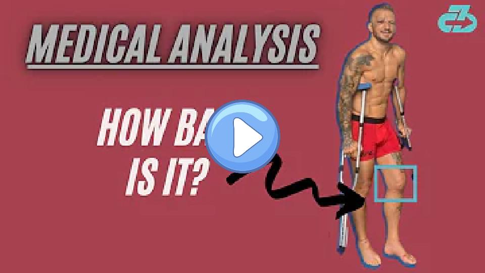 Video thumb: Expert Explains TJ Dillashaw's Knee Injury, Timeline, and Career Impact