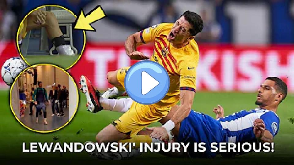 Video thumb: Sad News: Lewandowski's Injury vs. Porto Turns Out to Be Serious | Injury Update