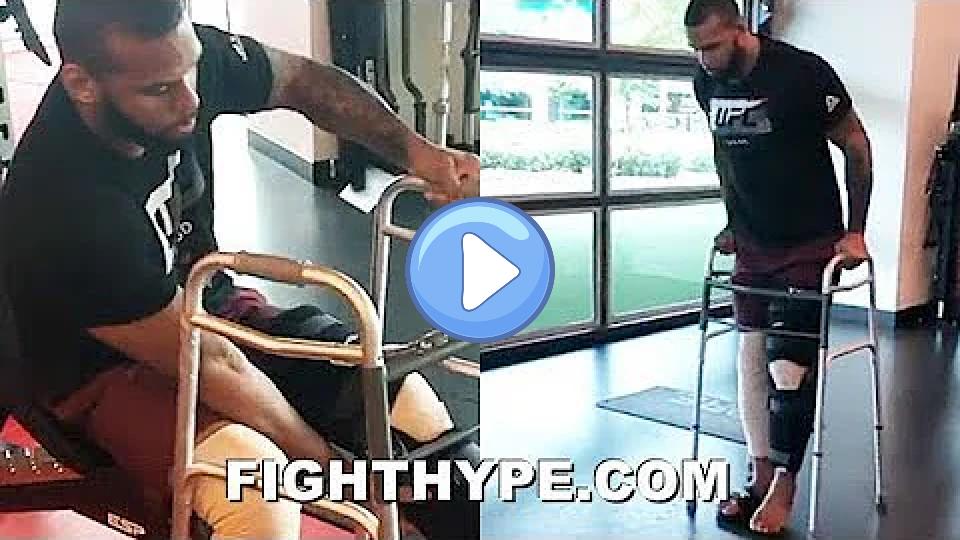 Play video: Thiago Santos Rehabbing Knee Torn in Jon Jones Loss; Begins Road to Recovery Video thumb: Thiago Santos Rehabbing Knee Torn in Jon Jones Loss; Begins Road to Recovery