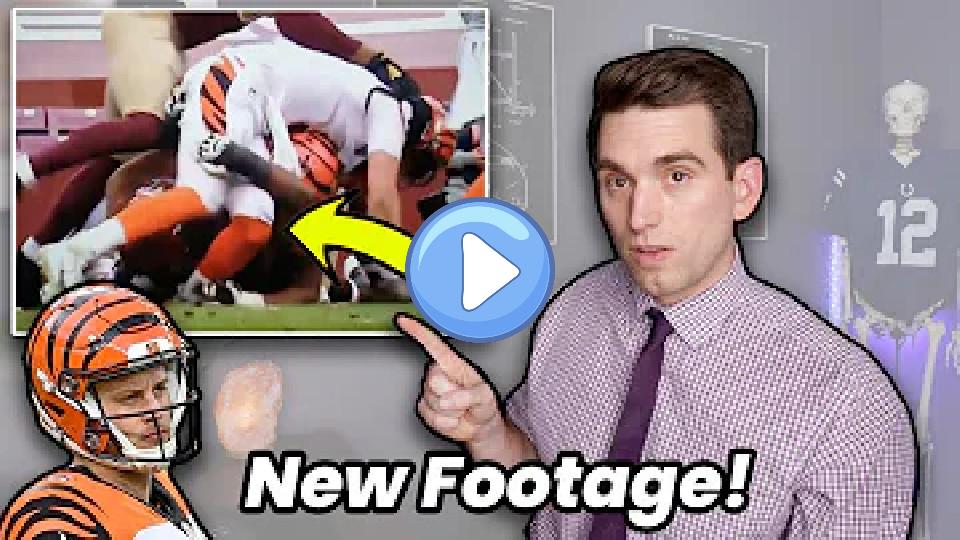 Video thumb: *New Footage* The Exact Moment Joe Burrow Tears ACL & Rare Insight Into ACL Function