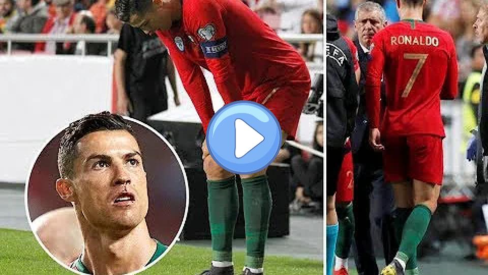 Video thumb: 8 Times Cristiano Ronaldo Was Injured and Substituted 😰
