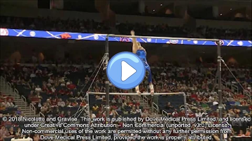 Video thumb: Ulnar collateral ligament injuries in female gymnasts – Video S1 [ID 159624]