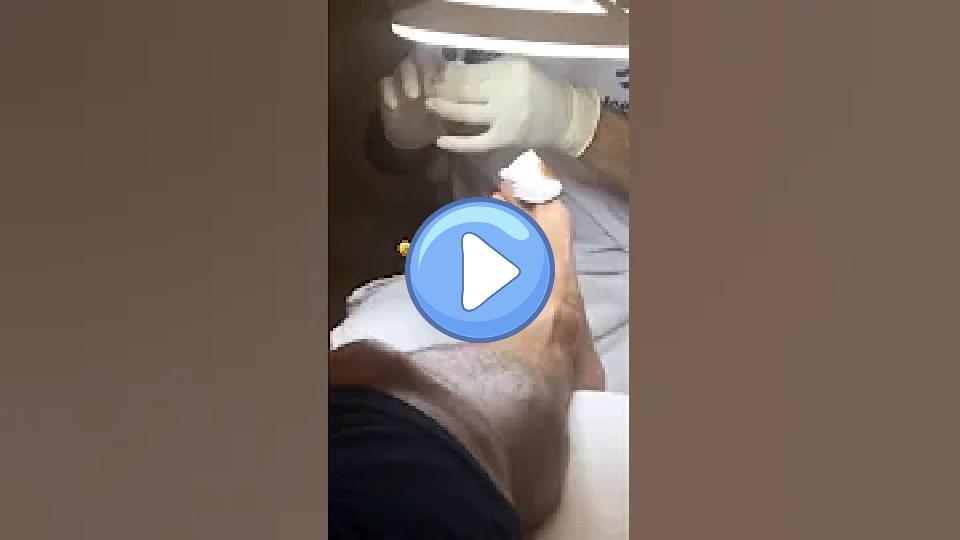 Video thumb: Miralem Pjanic's Injured Foot: What's Happening?