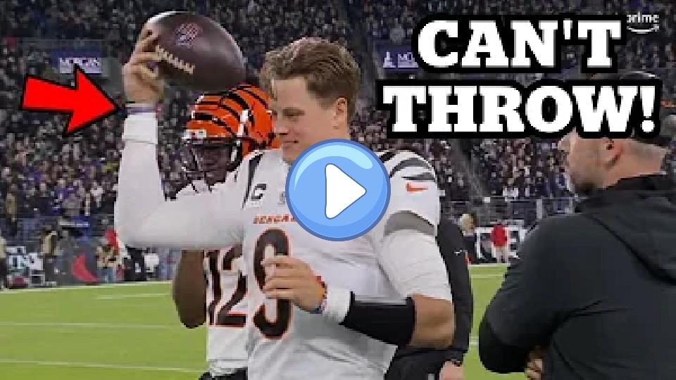 Video thumb: Joe Burrow Injured in Strange Sequence: Doctor Reacts