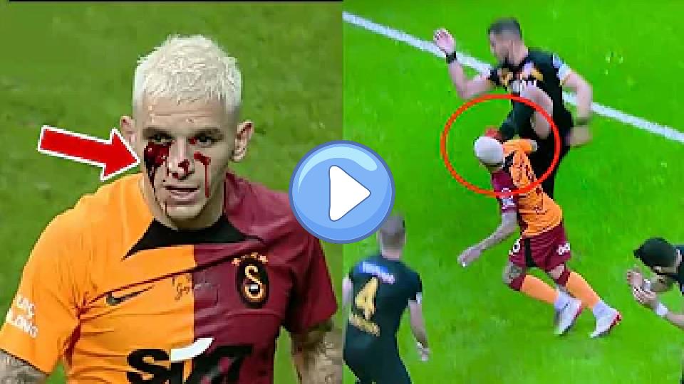 Video thumb: Lucas Torreira Injury vs Kayserispor