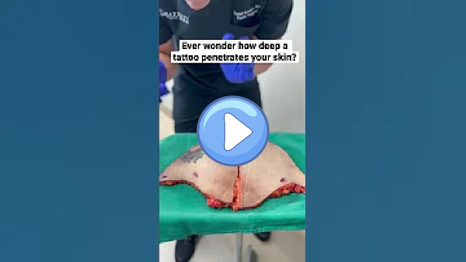 Video thumb: Ever wondered how deep a tattoo penetrates your skin? 😱 #mommymakeover #liposuction #tummytuck