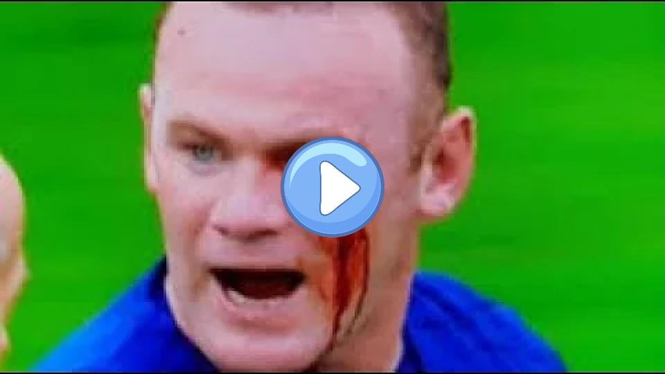 Video thumb: Wayne Rooney takes a violent elbow to the face - blood spills