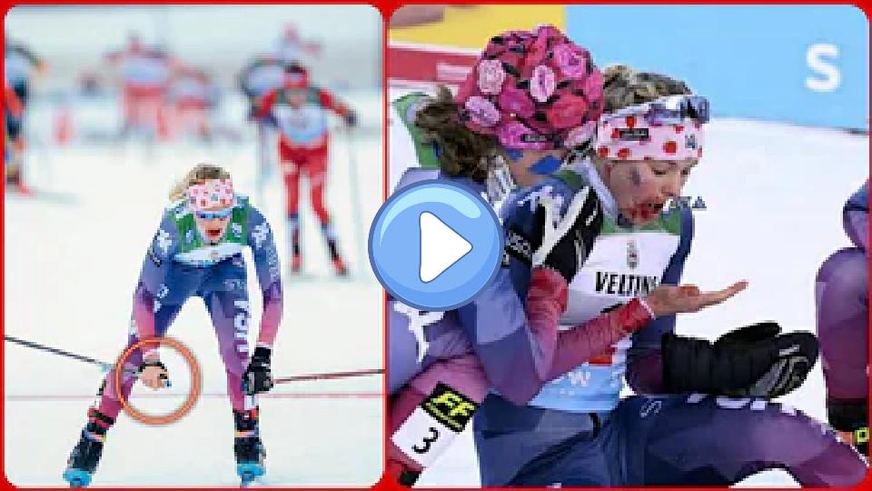 Video thumb: Jessie Diggins Ruka - Jessie Diggins, bloodied and missing a glove - Jessie Diggins ski accident