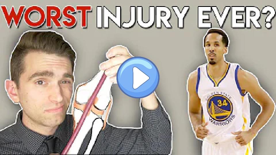 Play video: Explaining Shaun Livingston's Injury: A Doctor's Perspective on One of the Worst NBA Injuries Video thumb: Explaining Shaun Livingston's Injury: A Doctor's Perspective on One of the Worst NBA Injuries